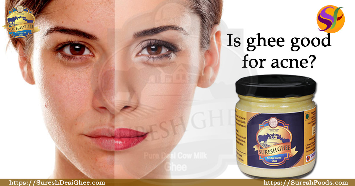 Is ghee good for acne : SureshDesiGhee.com